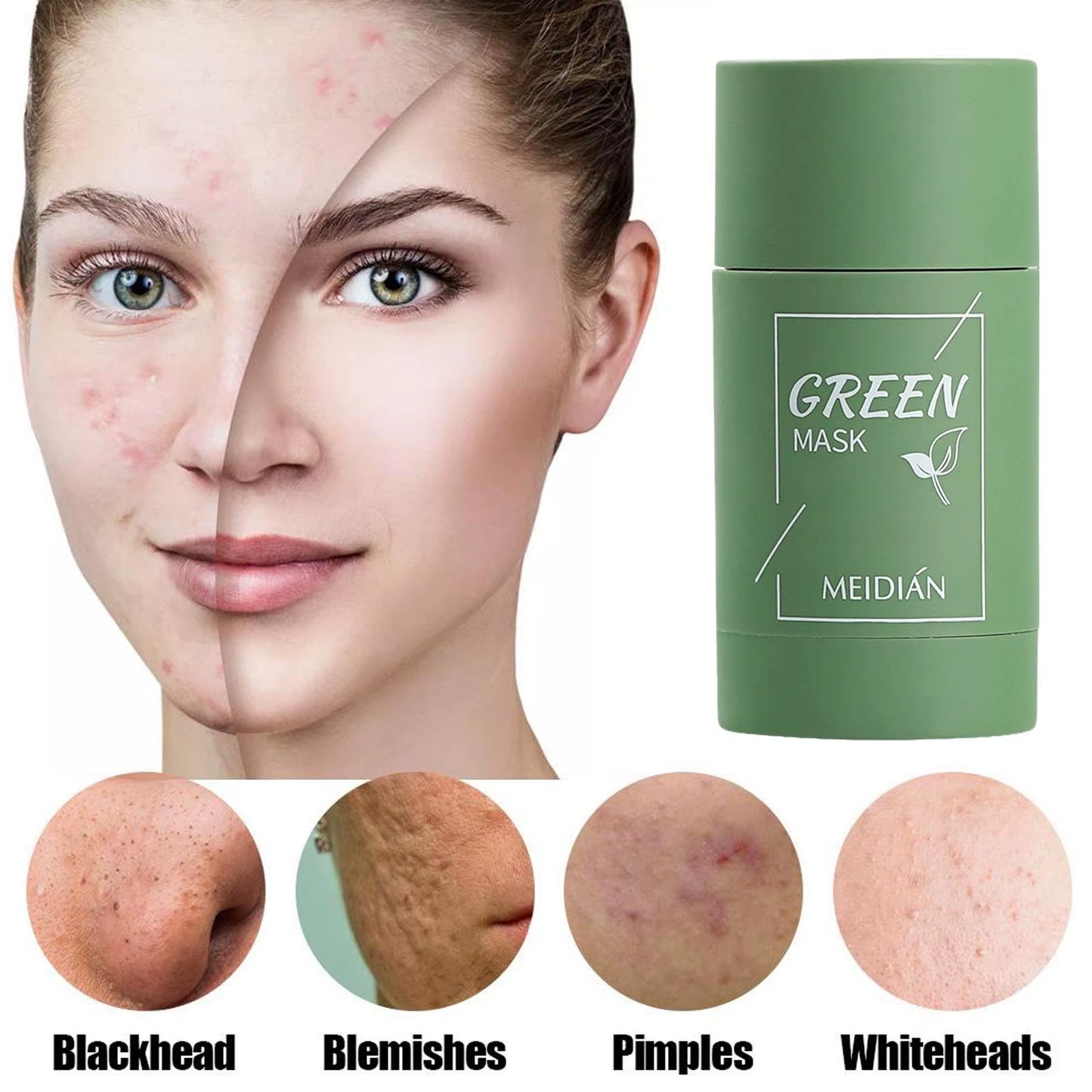 Mascarilla limpiadora sólida de té verde, crema para el tratamiento de imperfecciones de acné, eliminación de espinillas, fórmula vegetal Natural, solución suave para el cuidado de la piel