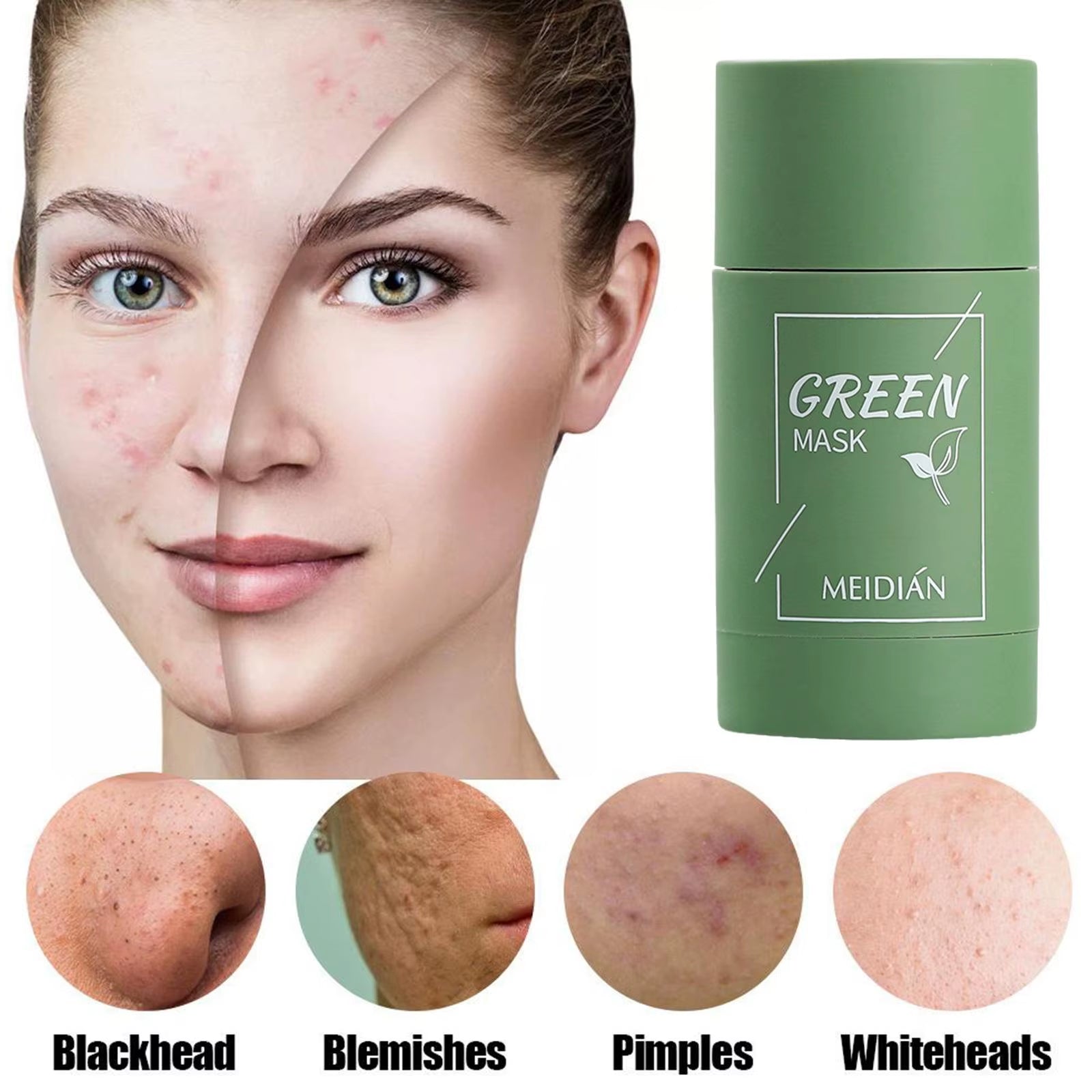 Mascarilla limpiadora sólida de té verde, crema para el tratamiento de imperfecciones de acné, eliminación de espinillas, fórmula vegetal Natural, solución suave para el cuidado de la piel