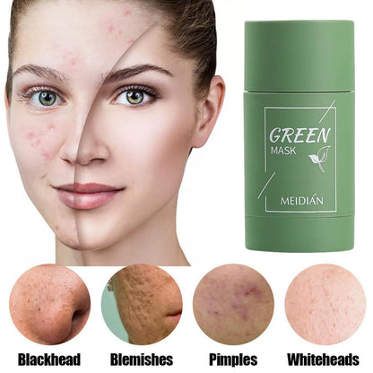Mascarilla limpiadora sólida de té verde, crema para el tratamiento de imperfecciones de acné, eliminación de espinillas, fórmula vegetal Natural, solución suave para el cuidado de la piel