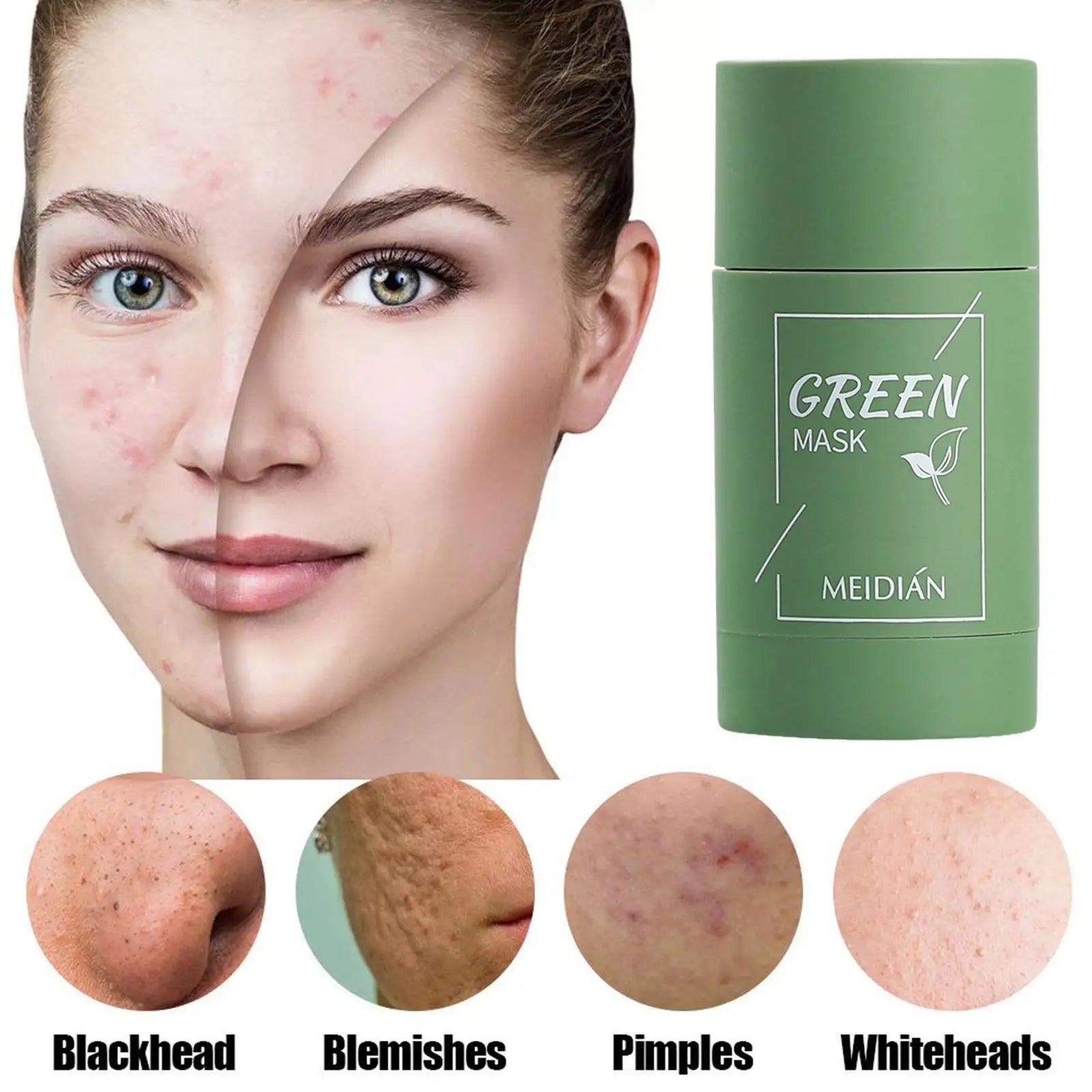 Mascarilla limpiadora sólida de té verde, crema para el tratamiento de imperfecciones de acné, eliminación de espinillas, fórmula vegetal Natural, solución suave para el cuidado de la piel