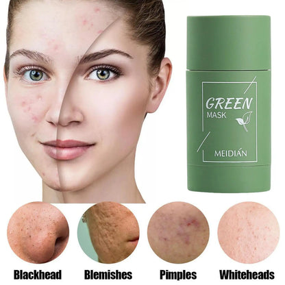 Mascarilla limpiadora sólida de té verde, crema para el tratamiento de imperfecciones de acné, eliminación de espinillas, fórmula vegetal Natural, solución suave para el cuidado de la piel